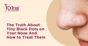 The Truth About Tiny Black Spots on Your Nose and How to Treat Them